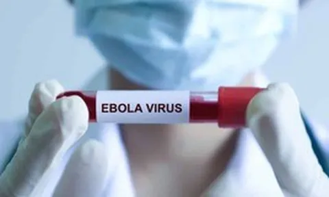 Bệnh Ebola tử vong đến 90%, Bộ Y tế ra chỉ đạo khẩn, yêu cầu cách ly nghiêm ngặt