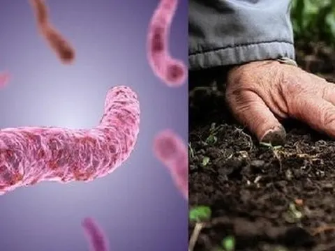 Khó thở và rét run người đàn ông phát hiện bị viêm phổi do vi khuẩn Whitmore