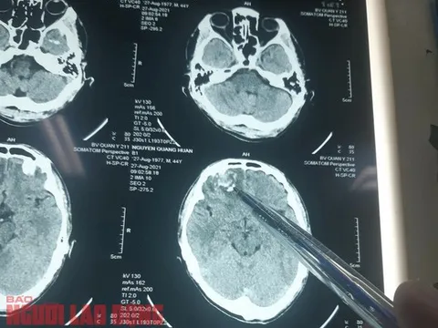 Bộ Công an vào cuộc vụ dân tố bị đánh tổn hại 35% sức khỏe, công an huyện không khởi tố