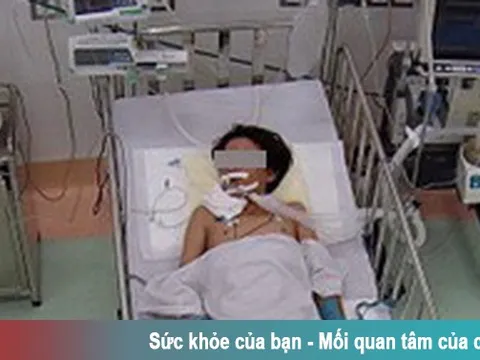 Bé trai nguy kịch do rắn cạp nia cắn khi đang nằm ngủ