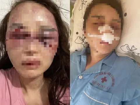 Cán bộ Quản lý thị trường đánh đập bạn gái dã man đã có vợ con