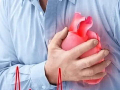 Bác sĩ hướng dẫn sơ cứu nhồi máu cơ tim đúng cách