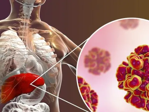 Tự ý dừng uống thuốc kháng virus viêm gan B - hậu quả khó lường