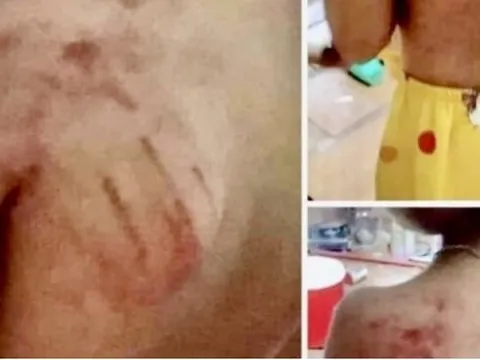 Kiểm điểm giáo viên đánh học sinh tiểu học ở Bà Rịa- Vũng Tàu