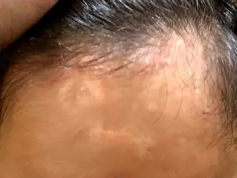 Diễn biến mới nhất vụ giao con nhờ chữa bệnh, bất ngờ nhận lại hũ tro cốt