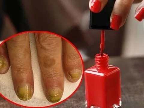 Tác hại khi sơn móng tay thường xuyên, không phải ai cũng biết