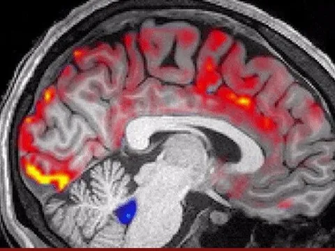 Điều gì xảy ra với não bộ khi bạn đang ngủ?