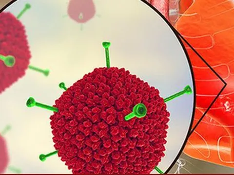 Hà Nội: Toàn bộ 30 quận, huyện, thị xã ghi nhận ca nhiễm virus Adeno