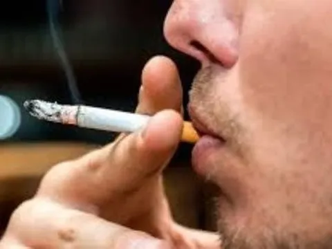 40 tuổi đã phải cắt lưỡi, bác sĩ chỉ ra dấu hiệu ung thư dễ nhầm lẫn nhiệt miệng