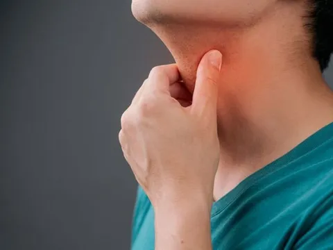 Đau họng, dùng kháng sinh không đỡ: BS chỉ ra nguyên nhân và cảnh báo biến chứng nguy hiểm