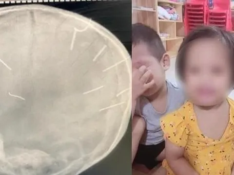 Từ vụ bé gái bị đóng 9 chiếc đinh vào đầu: Cha mẹ đừng vô tâm với con