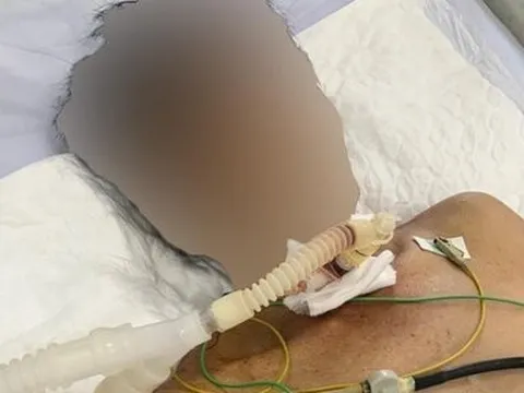 Quảng Nam: Cứu người đàn ông tự cứa cổ, đâm dao vào bụng