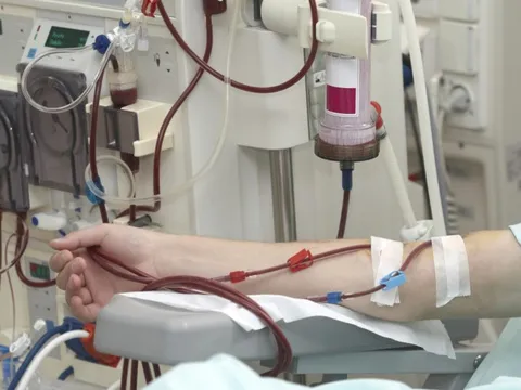 Bệnh nhân suy thận mạn đang ngày càng trẻ hóa