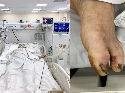 Cứu sống người đàn ông co cứng toàn thân sau khi cọc nhọn đâm vào chân