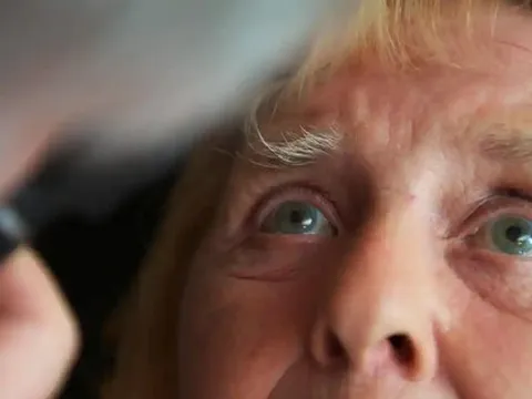 Giấc ngủ kém có thể dẫn đến mù loà