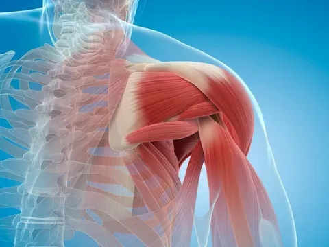 Mỹ phát triển chất kết dính ngăn ngừa và phục hồi teo cơ