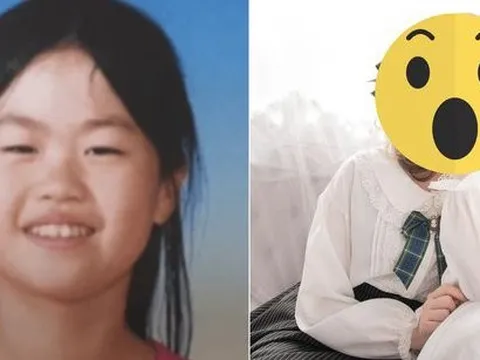 Chi tiền tỷ làm phẫu thuật từ năm 18 tuổi để được “giống người thường”, diện mạo của idol người Nhật bây giờ ra sao?