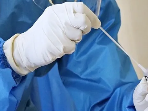 Tiếp xúc với SARS-CoV-2 có được công nhận là bệnh nghề nghiệp hưởng BHXH?