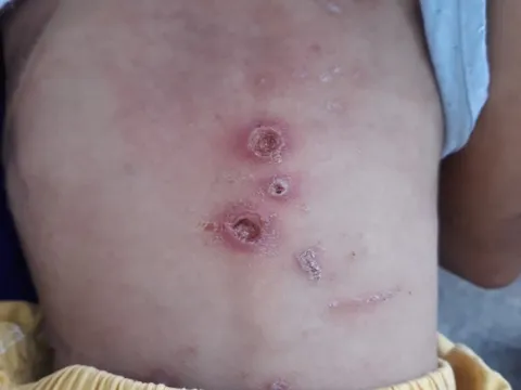 Bé trai 2 tuổi nghi bạo hành tại Hóc Môn hiện ra sao?