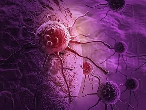 Bất ngờ tác dụng chống ung thư của loại thuốc cực kỳ phổ biến