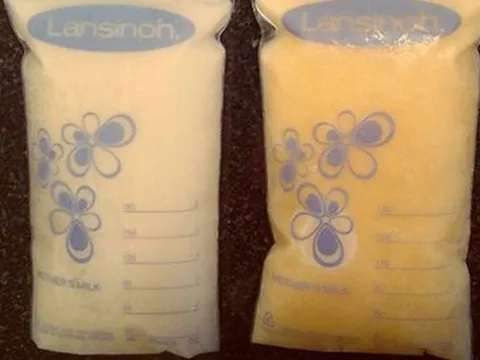 Sốc với bức ảnh về sự thay đổi kỳ diệu của sữa mẹ khi bé bị ốm