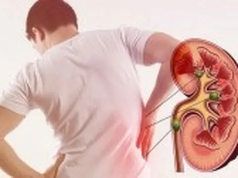 Suy thận ở thanh thiếu niên và dấu hiệu cảnh báo sớm