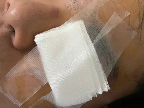 Nam thanh niên nhập viện vì "va vào gậy của CSGT" nói gì?
