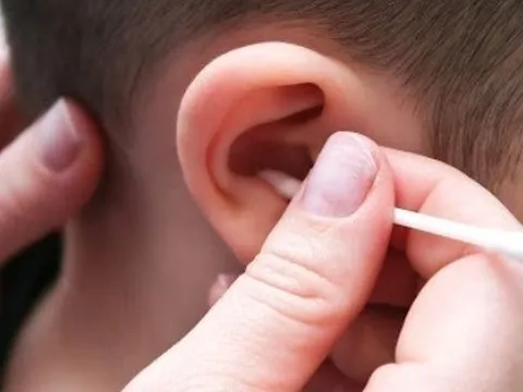 Bé trai 5 tuổi bị thủng màng nhĩ do ngoáy tai