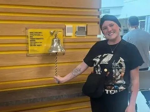 Nữ sinh 22 tuổi phát hiện ung thư sau khi thấy dấu hiệu này ở nách