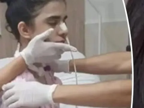 Hít phải ớt siêu cay, cô gái bị phù não, hôn mê nhiều ngày