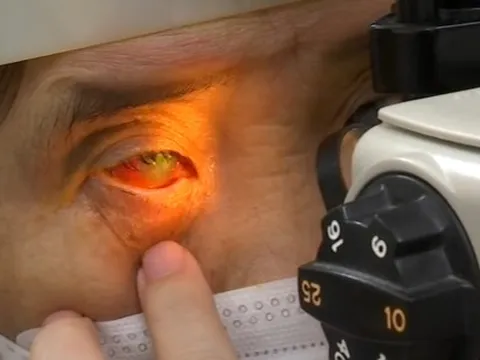 Có nên ngủ chung với người bị đau mắt đỏ?