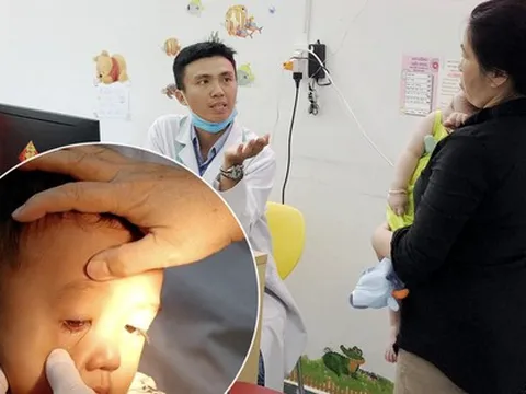 Bác sĩ: Cần phân biệt đau mắt đỏ do virus hay vi khuẩn, có các triệu chứng sau phải đi khám ngay