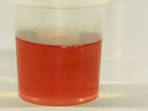 Muốn biết sức khỏe tốt hay không hãy nhìn vào 4 đặc điểm này khi đi tiểu