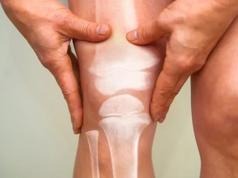 6 dấu hiệu trên cơ thể cảnh báo ung thư xương đã “gõ cửa”: Người trẻ càng phải đề phòng