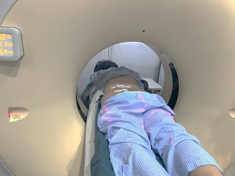 Người bệnh ung thư không còn ám ảnh với cơn đau nhờ kỹ thuật mới