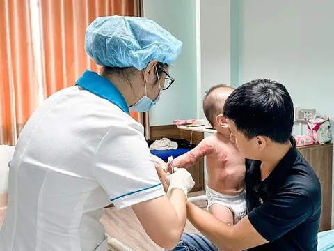 Va vào bình nước sôi để pha sữa, bé 13 tháng tuổi bỏng nặng