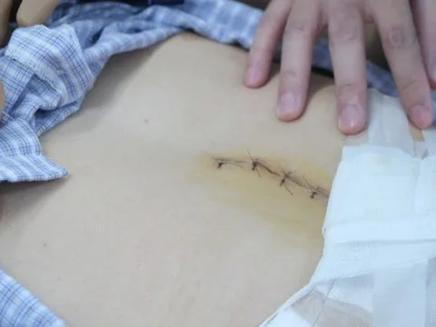 Thanh niên xuất huyết ồ ạt vì thức khuya, ăn uống không điều độ