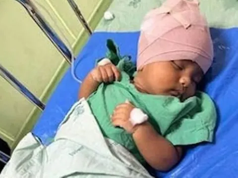 Khỉ hoang đột nhập vào nhà, cắn chảy máu đầu bé trai 3 tháng tuổi