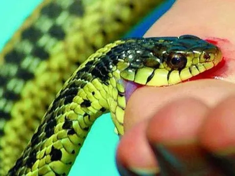 Nghệ An: Theo ông bà lên rẫy, bé trai 8 tuổi bị hoại tử bàn tay nghi do rắn cắn