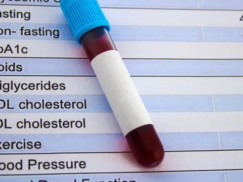 "Cholesterol tốt" quá cao cũng đáng lo