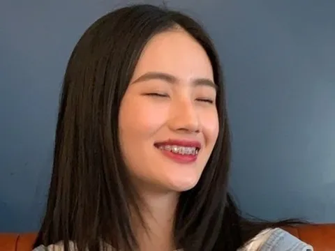 Ảnh thời còn niềng răng của tân Hoa hậu Huỳnh Trần Ý Nhi