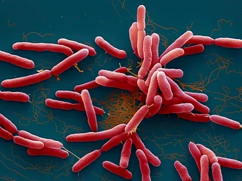 Thêm một trường hợp mắc bệnh Whitmore tại Đắk Lắk