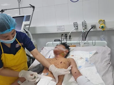 Bé trai thủng bụng, lộ nội tạng do chơi pháo