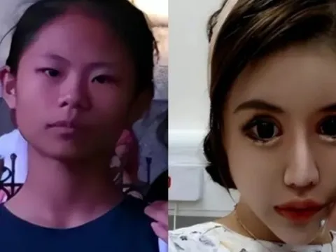 Cô gái nghiện làm đẹp từ năm 13 tuổi, chi 14 tỷ đồng để phẫu thuật thẩm mỹ, hiện tại hối hận nhưng đã muộn màng