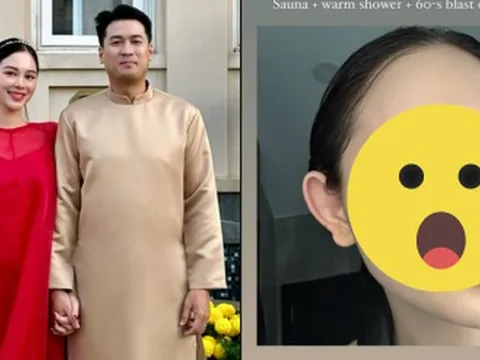 Phu nhân hào môn Linh Rin công khai mặt mộc hậu sinh con đầu lòng, nhan sắc liệu có gây bất ngờ?