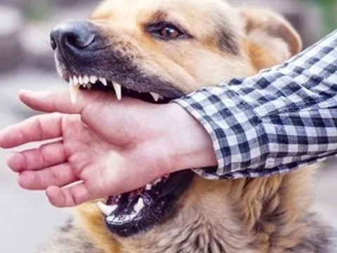 Tử vong do bệnh dại tăng, Bộ Y tế khuyến cáo cách phòng chống