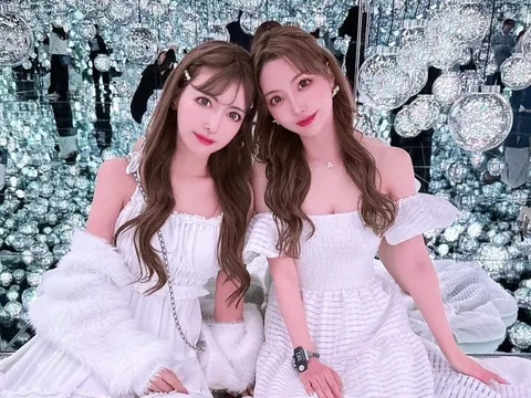 Cặp sinh đôi chi gần 8 tỷ đồng để có visual búp bê, nhan sắc quá khứ khác hẳn