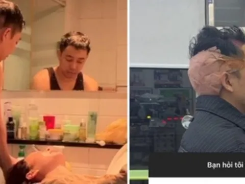 Sốc với diện mạo hiện tại của cặp bạn thân nổi tiếng khi chi 742 triệu sang Hàn Quốc cấy tóc