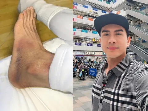 Nam ca sĩ Việt vừa đi vừa xem điện thoại bị ngã ở trời Tây: "Đau thấu trời xanh" còn bị mất thêm 500€