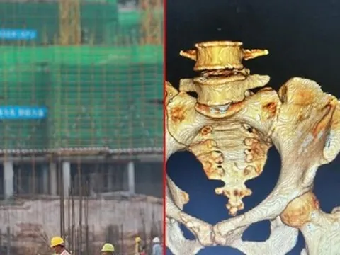 Thêm 1 vụ tai nạn lao động ở công trường xây dựng, nữ công nhân bị thanh sắt rơi trúng, đâm xuyên người